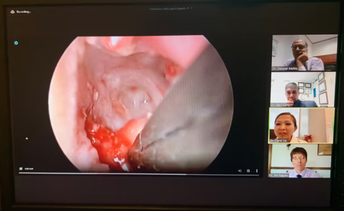 Treatment of Chronic Atelectatic Middle Ear with Endoscopic Placement of Cartilage Shield T-tube