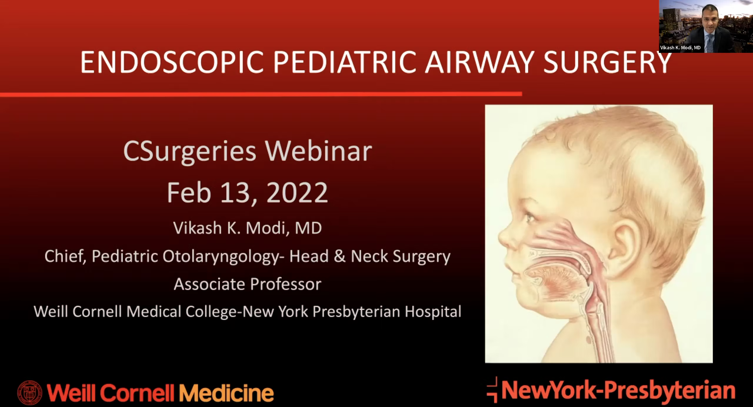 Pediatric Endoscopic Airway Surgery